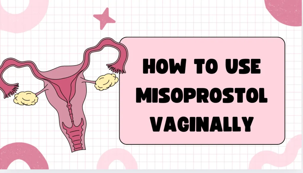 How to Use Misoprostol Vaginally: A Comprehensive Guide