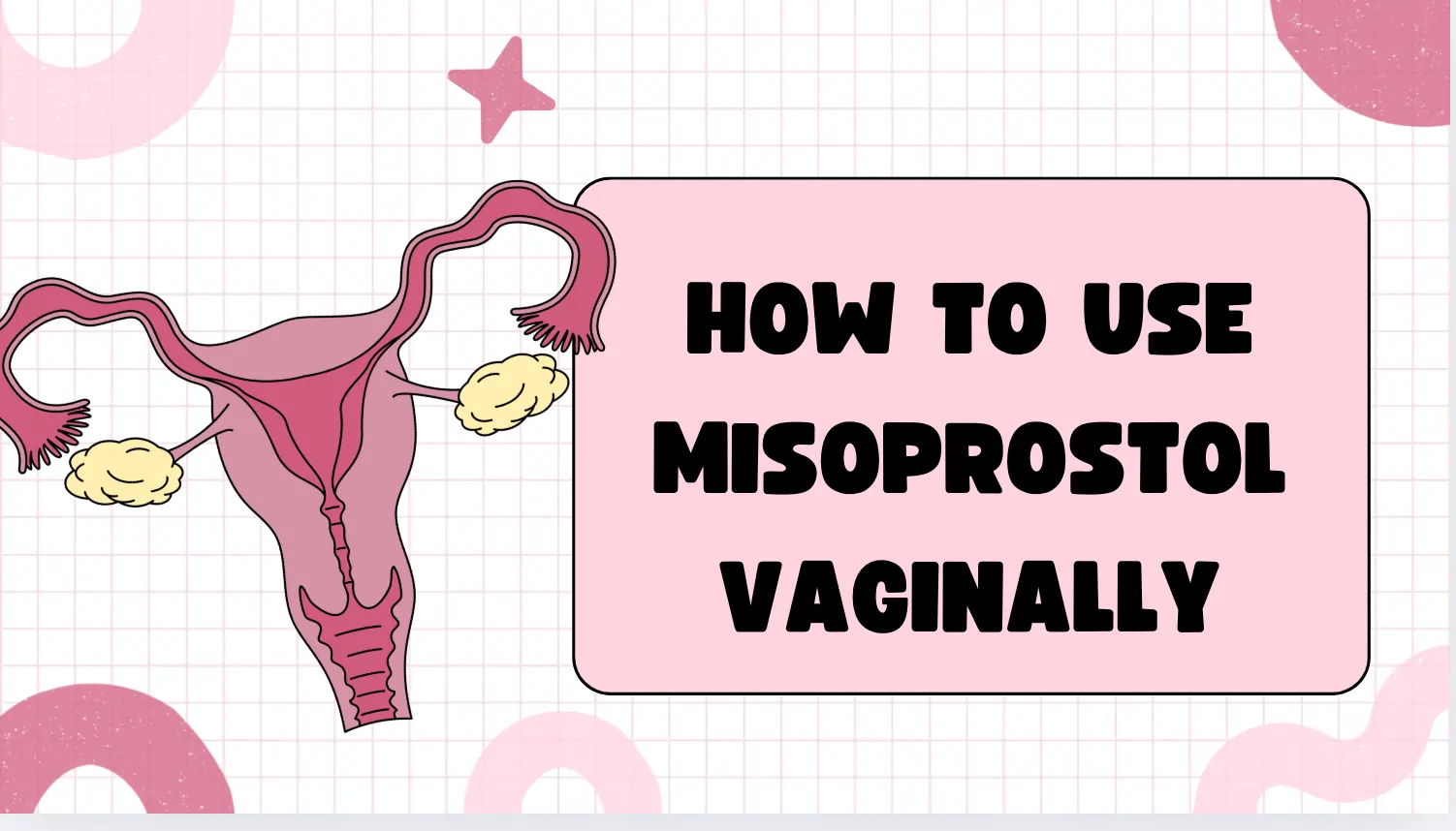 How to Use Misoprostol Vaginally: A Comprehensive Guide